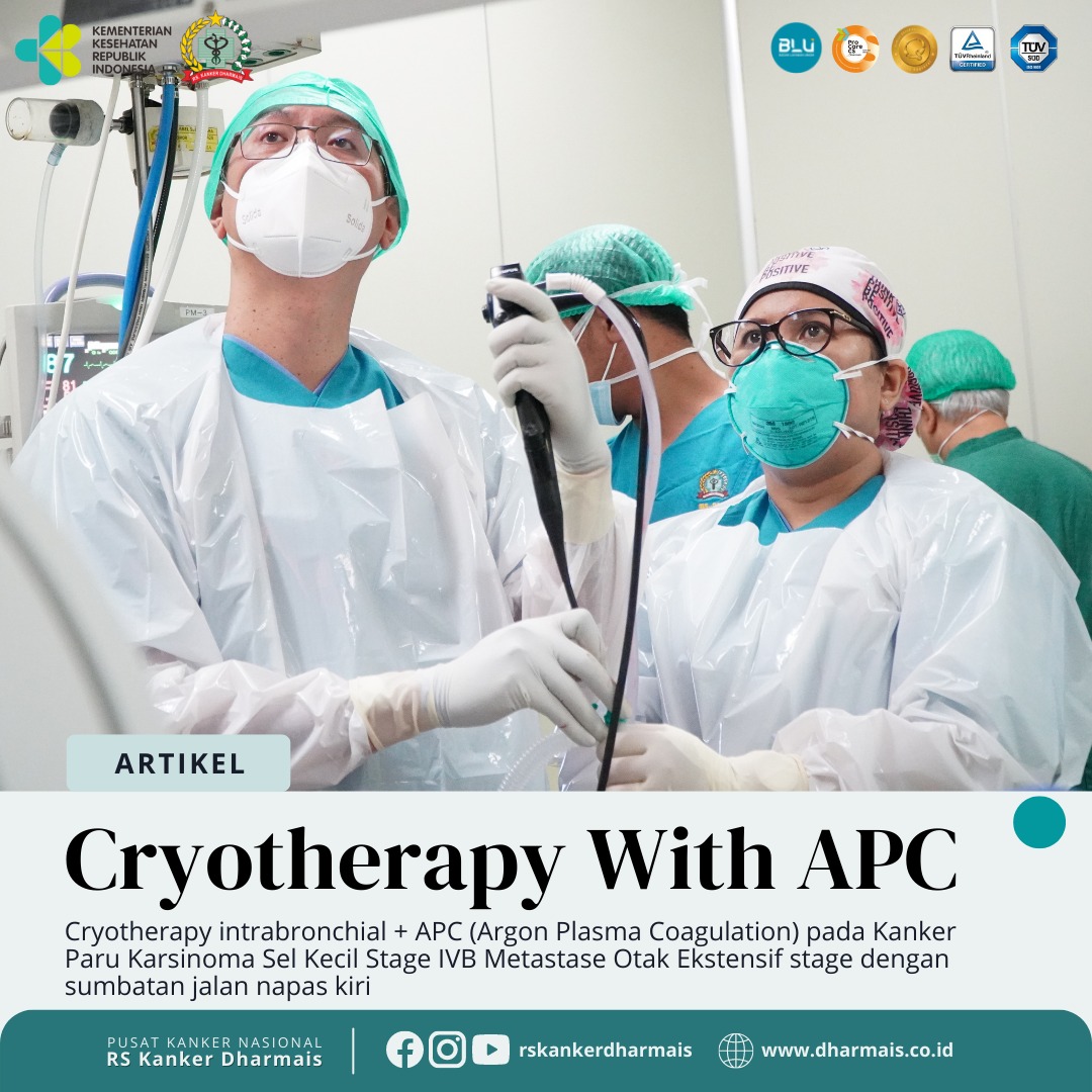Cryotherapy intrabronchial + APC
